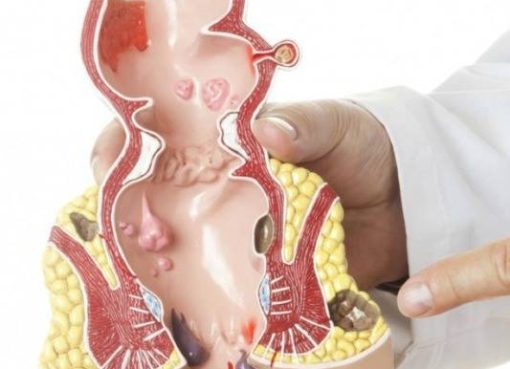 الحلول الحديثة للتخفيف