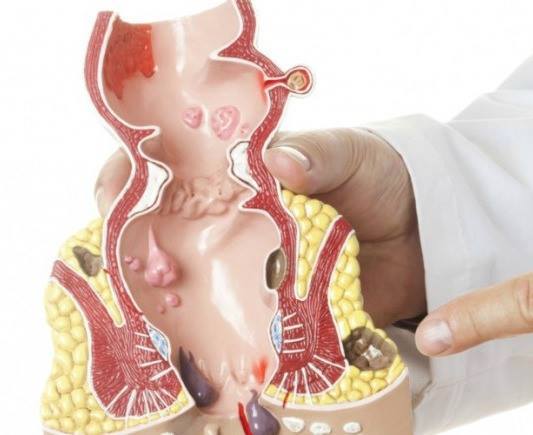 الحلول الحديثة للتخفيف